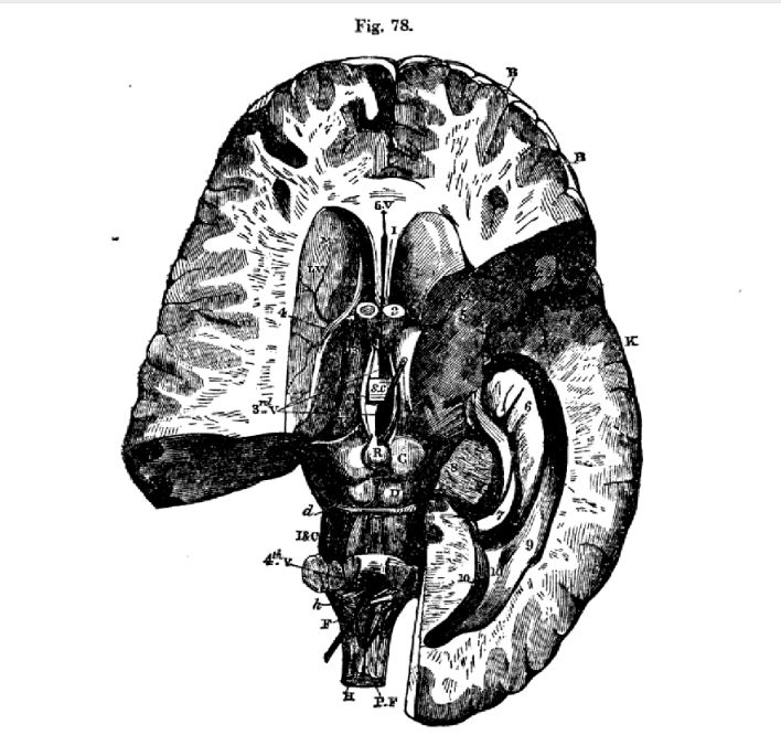 Nineteenth century image of dissected human brain from Samuel Solly 1848