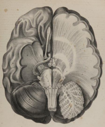 Coronal view of dissected brain through cerebellum, temporal lobe and frontal lobes