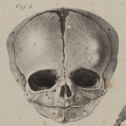 infant skull