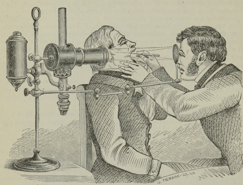 antique laryngoscope