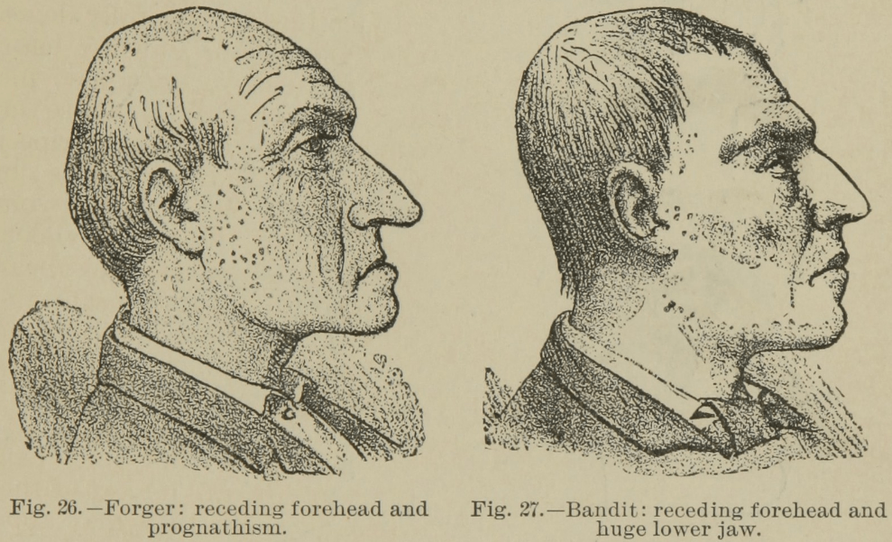 bandit and forger phrenology
A System of Legal Medicine. A.L. Hamilton & L. Godwin, 1894