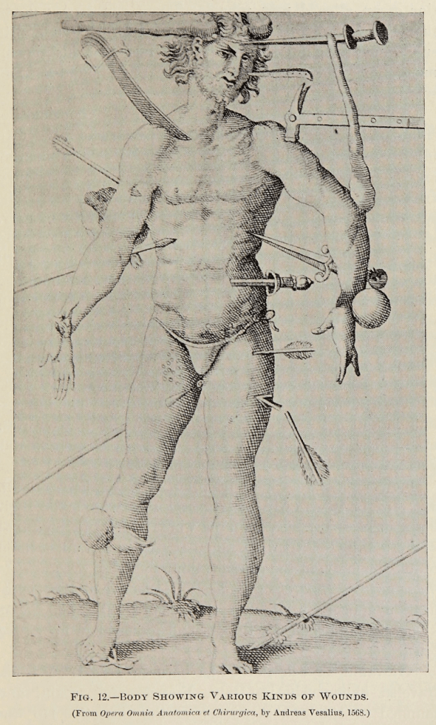 Medical illustration of man wounded by many types of weapon, arrows, daggers, swords, clubs, etc.