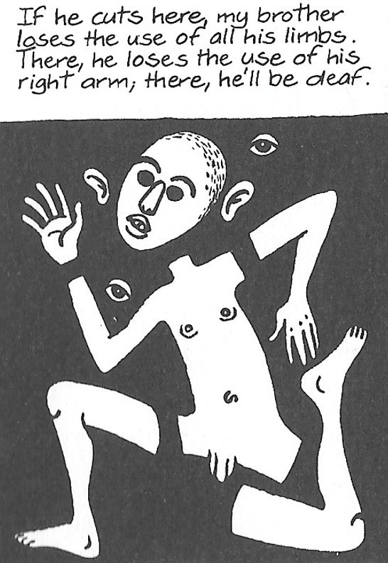 Cartoon showing how a patient can be affected by brain surgery.