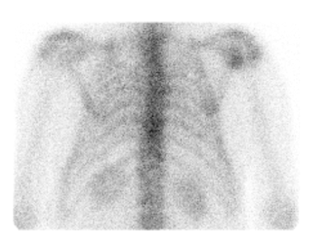 rib cage and vertebrae bone density scan of elderly man